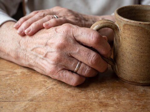 A macro photograph of the hands of an elderly woman resting on a table affected by osteoarthritis, her finger knuckles visibly enlarged and slightly deviated as she struggles to grip the handle of a c