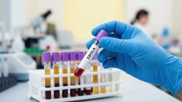 Laboratory worker holding Bundibugyo Ebola virus testing tube during infectious disease monitoring and outbreak preparedness in clinical research facility