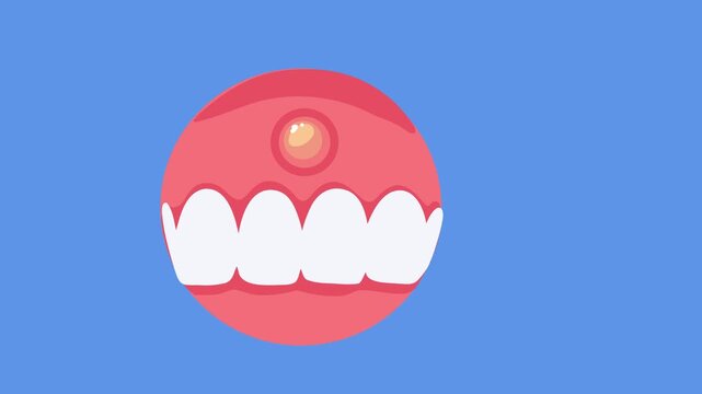 animation gum abscess with pus dental