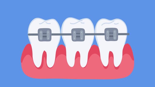 animation dental braces treatment process