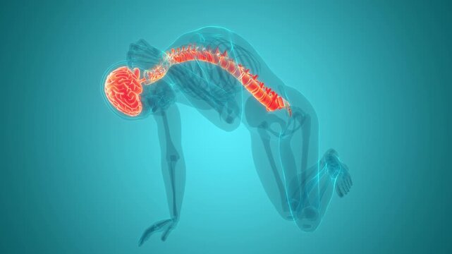 Human Suffering with Severe Headache Anatomy Animation Concept