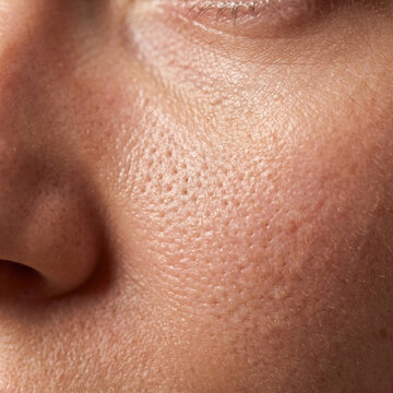 Human skin texture macro close up enlarged pores on female cheek nose dermatology skincare problem concept