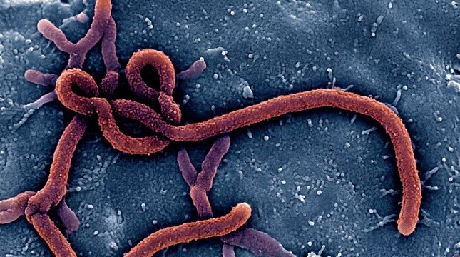 Scanning electron micrograph of ebola virus particles on a cell surface