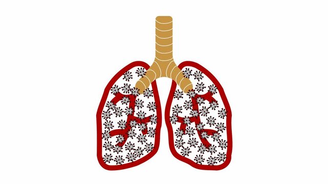 video illustration of human lungs infected the Ebola hantavirus monkeypox mpox corona covid TBC Tuberculosis viruses in 4k resolution in white background