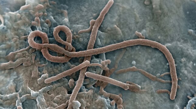 Ebola virus particles visualized under a scanning electron microscope