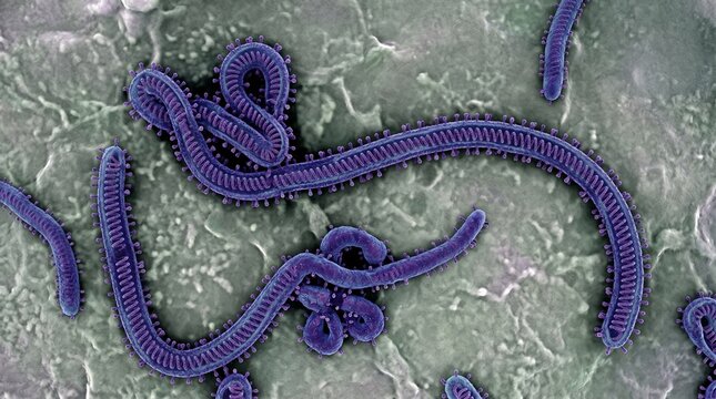 Scanning electron micrograph of ebola virus particles