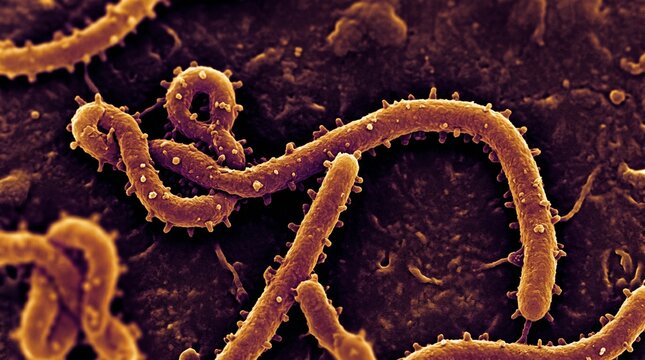 Scanning electron micrograph of ebola virus particles