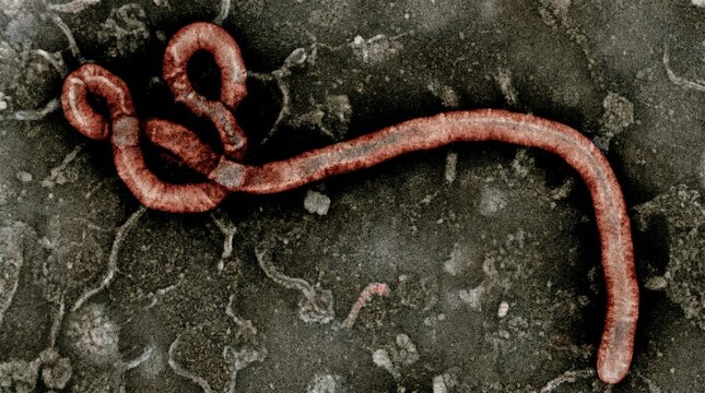Transmission electron micrograph of ebola virus particles