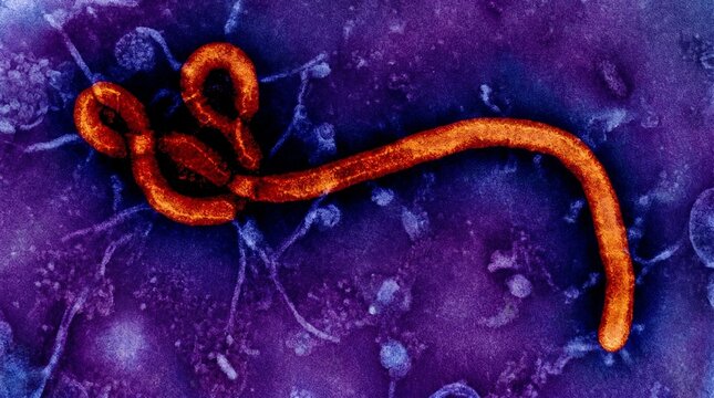 Ebola virus particles under electron microscope