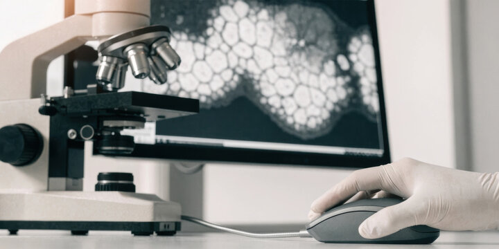 Medical technology laboratory microscope and researcher analyzing cellular sample with gloved hand using computer mouse in lab