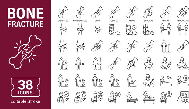 Bone fracture line icons set. Orthopedic medicine, broken bones, trauma, surgery, casting, and healing collection. Professional medical outline icon set. Editable stroke vector illustration for web.