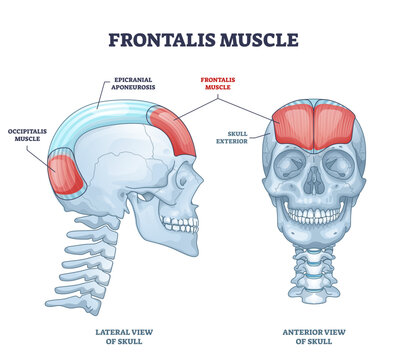 Frontalis muscle with human head facial muscular system outline diagram, transparent background. Labeled educational medical scheme.