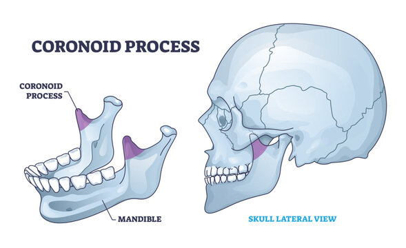 Coronoid process anatomy with isolated bone and skull view outline diagram, transparent background. Labeled educational scheme with mandible as chin medical skeleton illustration.