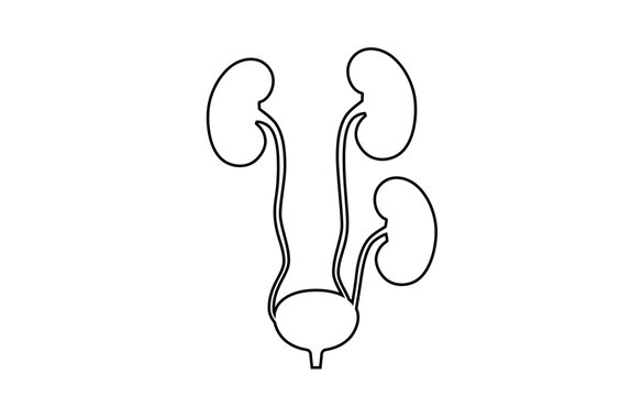 Kidney transplant surgery