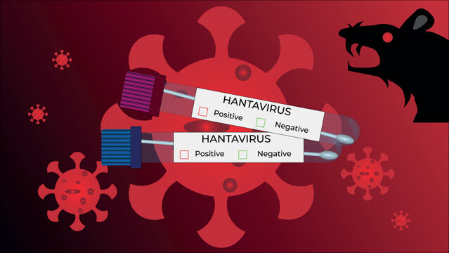 Hantavirus medical infographic banner. Vector illustration with positive and negative blood test tubes, virus cells structure background, and a silhouette of a rat as a disease vector.