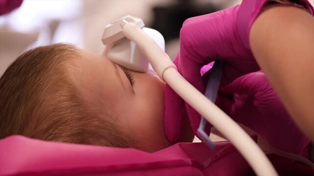 Close up footage of a child receiving inhalation sedation before a dental procedure while dental professionals work together to prepare treatment. Medical staff wearing protective gloves carefully pos