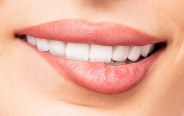 Naklejka premium Human mouth close-up showing white teeth and glossy lips