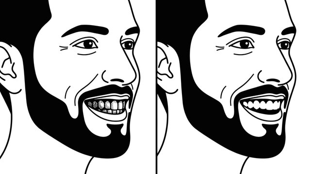 Smiling man with beard and teeth.
