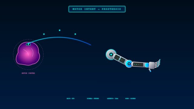 a clinical BCI neural connection interface displays brain motor intent pulses transmitted to a mechanical robotic limb limb movement sequence captured on a dark digital display
