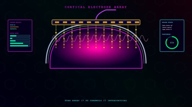 A BCI neural connection displayed within a digital interface monitor showing glowing sensor nodes and analytical data bars pulsating in a dark electronic scientific medical environment
