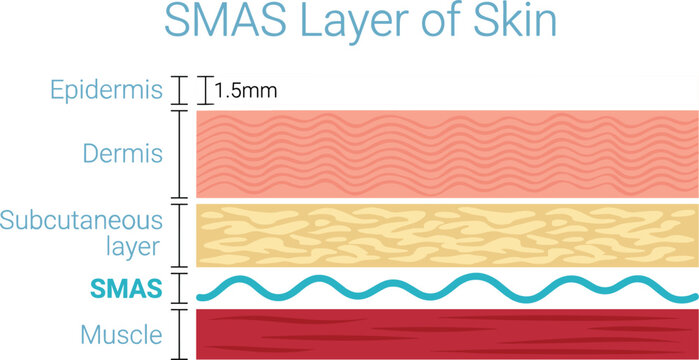aSMAS layer of skin vector diagram showing cross section anatomical levels from epidermis down to muscle tissue