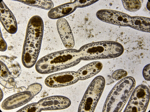 Original Gram staining image of Agrobacterium tumefaciens, plant pathology specimen, naturally heterogeneous staining.