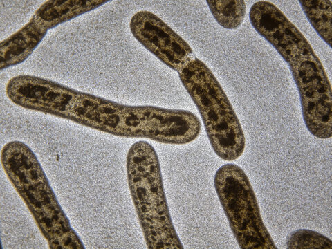 Original optical micrograph of Legionella pneumophila, Gram staining, a true respiratory pathogen, a pleomorphic bacillus.
