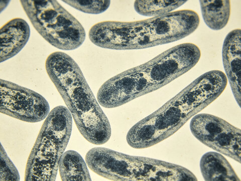 Original optical micrograph of Bacteroides fragilis, Gram staining, typical anaerobic intestinal bacteria, pleomorphic bacillus, with natural and uneven staining.