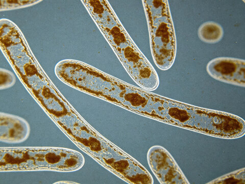 Original optical micrograph of Fusobacterium nucleatum, Gram staining, typical oral anaerobic bacteria, fusobacterium, naturally uneven staining.