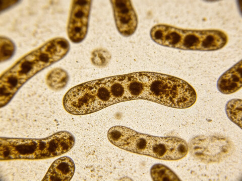 Original optical micrograph of Propionibacterium acnes, Gram staining, a true dermal commensal bacterium, a small, pleomorphic bacillus.