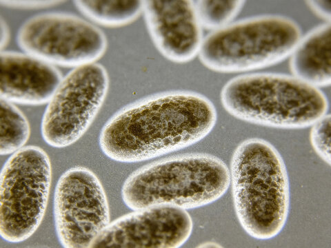 Original optical micrograph of Haemophilus parainfluenzae, Gram staining, symbiotic respiratory bacteria, cocci.