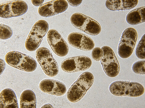 Original optical micrographs of Enterococcus faecium, Gram staining, vancomycin-resistant enterococci (VRE), and paired cocci.