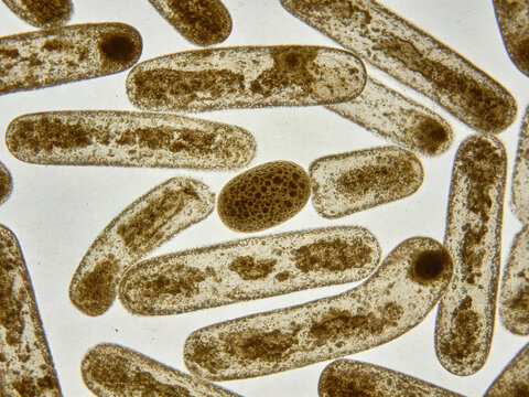Original optical micrograph of Bacillus anthracis, Gram staining, anthrax pathogen, large rectangular rod-shaped bacterium, central spores