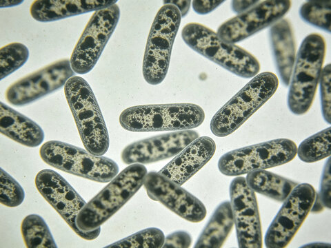 Original image of Listeria ivanovii, Gram staining, animal pathogen, showing small rod-shaped bacteria in a rolling motion.