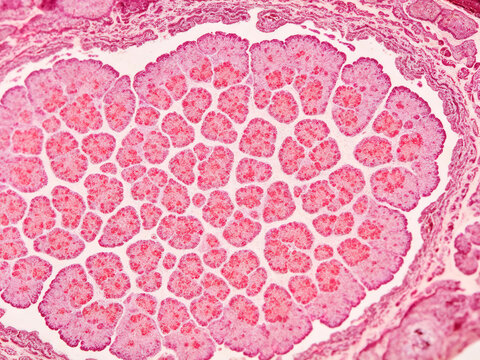 The original image of liver glycogen stained with periodic acid-Schiff stain shows characteristic pink glycogen granules with natural histological contrast. (Liver tissue section)