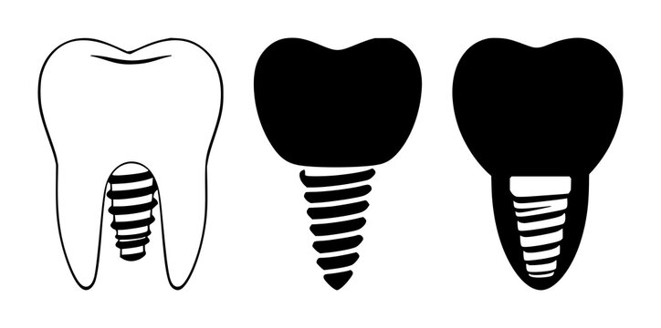 Dental implant tooth icon set with solid black icon on white background featuring dental, implant, tooth with iconography and white backdrop