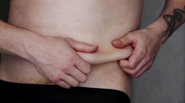 A fat belly in a man.
Excess weight and obesity due to poor diet and lifestyle.