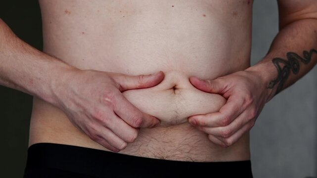 A man shows off his belly fat close-up, his obesity issues, and his dietary inconsistency.
The weight loss process