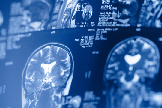 Medical scans show detailed images of brain structures taken at a hospital radiology department during a routine exam for patients