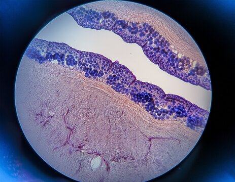 microscopic view of desquamated squamous cells from oral mucosa with dense blue bacterial colonies on right cell using he stain clean commercial composition professional context realistic detail