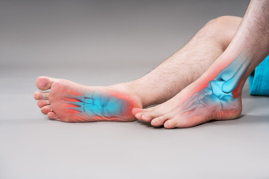 Joint diseases, hallux valgus, plantar fasciitis, heel spur, leg hurts, pain in the foot, male feet closeup