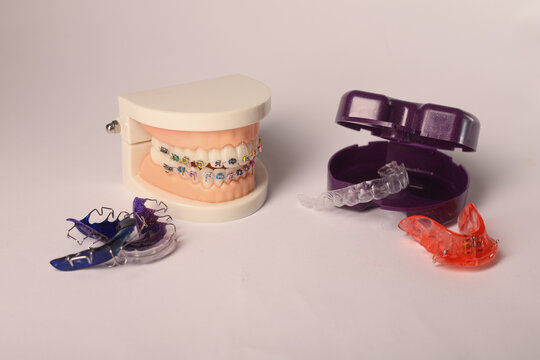 Dental braces model with orthodontic appliances isolated on white background. Concept of teeth straightening, smile correction, and modern dentistry.