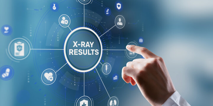 A radiologist analyzes detailed X-ray results on a digital medical viewing screen