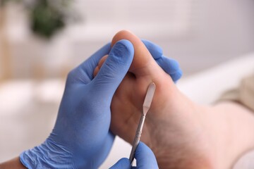 Fototapeta premium Podiatrist removing dead skin from client's foot with chisel tool indoors, closeup