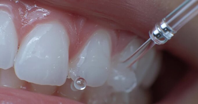 Dental water flosser cleaning plaque from teeth. 4K Video. Slow-motion water flosser jet cleaning between healthy teeth. Advanced oral hygiene.