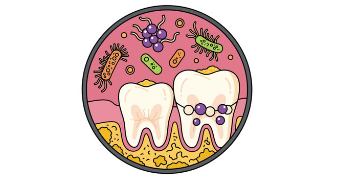Dental Health Illustration with Teeth Braces and Oral Bacteria