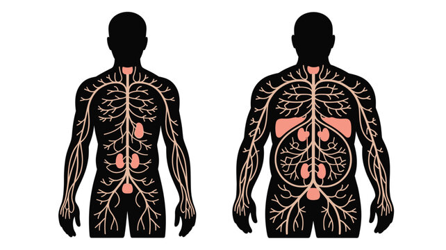Comparative illustration of the human lymphatic system showing lymph nodes and vessels in two different body types.