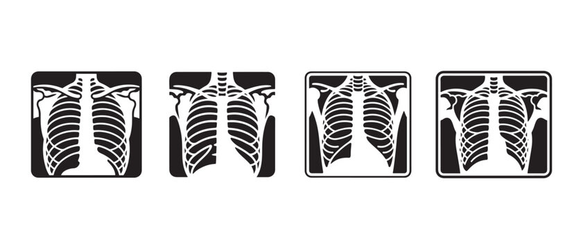 Set of four black and white human chest rib cage x-ray icons for medical and healthcare diagnostic design.