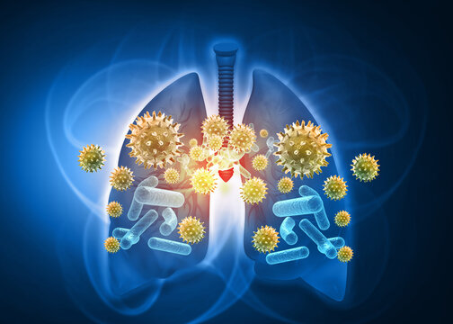 Anatomical human lungs with viral pathogens and bacterial infection on blue medical background.