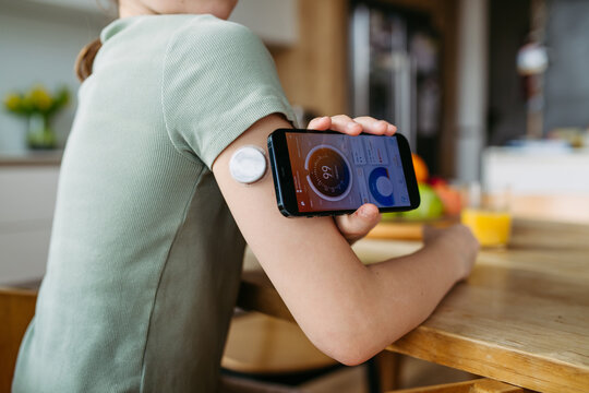Teen girl with diabetes scanning glucose level using CGM sensor and smartphone.